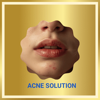 acne solution
