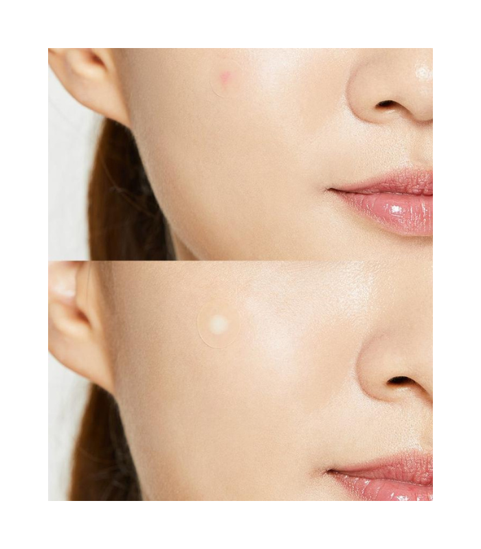 COSRX Acne Pimple Master Patches